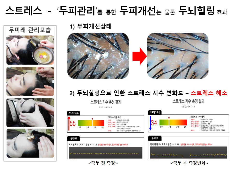 두미래 케어 전후 두피개선